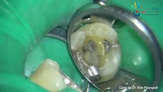 Practical endodontics in real world - [Dr. Kim Pyungsik]