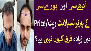 Price of Hair transplant | Hair surgery Cost | Cost Of Hair Transplant In Pakistan | Dr Zunair Munir