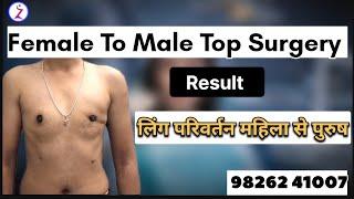 Gender change surgery mumbai pune Bangalore hyderabad .best female to male top  surgery in India