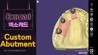 치과기공사 엑소캐드 커스텀어버트먼트 디자인 / exocad custom abutments design