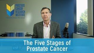 The Five Stages of Prostate Cancer | Prostate Cancer Staging Guide