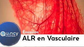 Emission ALR et chirurgie vasculaire 2019