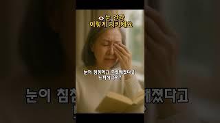 안과 의사가 말합니다. 시력 지키는 핵심 3가지!⭐구독하고 더 많은 꿀팁 받아 가세요 #눈건강 #시니어건강 #안과추천 #백내장예방 #눈피로해결 #눈마사지 #루테인음식 #시력보호