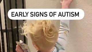 EARLY SIGNS OF AUTISM IN TODDLER @TheRealEspinozas