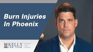 Phoenix Burn Injury Lawyer - Kelly Law Team