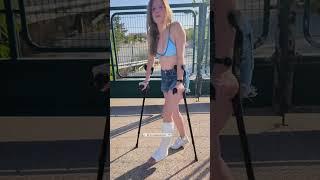 Casted summer: Plaster cast funny day vlog (full video on comments)