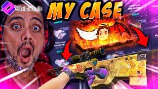 ANGVIL CASE MADE IT TO SKINCLUB! A DREAM COME TRUE #giveaway