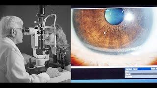 Before Cataract Surgery - What I Wish I Knew (1/4) (4K)