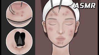 Skincare Stop Motion ASMR | Remove Makeup & Facial Treatment  | Pop Pimples 【Mengmation】