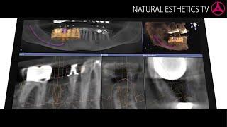 Biomedical engineering: Guided Implantology