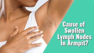 Swollen Lymph Nodes in Armpit & How To Know If It's Cancer