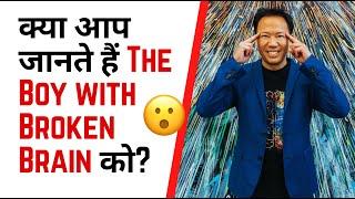 क्या आप जानते हैं 'The Boy with Broken Brain' को?  | Factovation | Purnima Lodha #facts #motivation