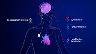 Barostim Mechanism of Action