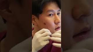 #실리프팅 장인만 할수있는 셀프시술! #실루엣소프트