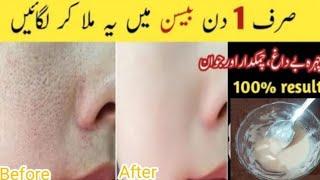 Besan Face Pack For glowing skin|Homemade Face Pack For glowing skin|Naturally Glowing skin remedy