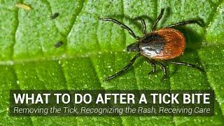 What to Do After a Tick Bite - Johns Hopkins Lyme Disease Research Center