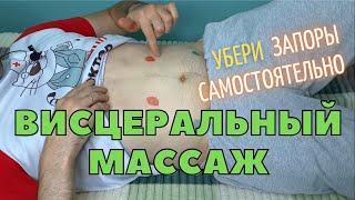 Самостоятельный массаж живота. Висцеральный массаж по отделам. Кинезиология