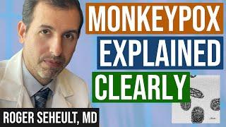 Monkeypox (Mpox) Explained Clearly