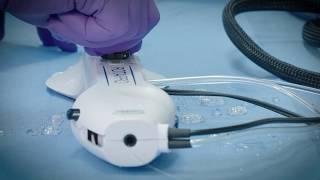 ROTAPRO™ Rotational Atherectomy System: System Operation and Removal