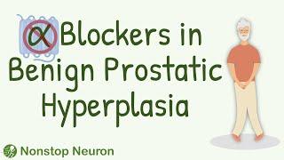 How Alpha Blockers Help in Benign Prostatic Hyperplasia?