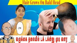 வழுக்கை தலையில் டக் டக்ன்னு முடி வளர |To grow hair on a bald head