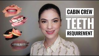 Cabin crew teeth requirements | Days with Kath