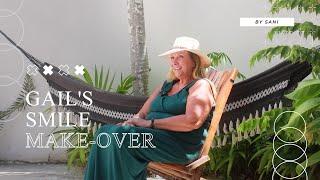 Smile Makeover in Playa del Carmen: Patient's Journey at Sani Dental Group