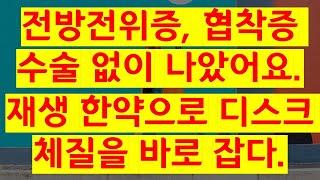 전방전위증, 협착증 수술 없이 나았어요.
