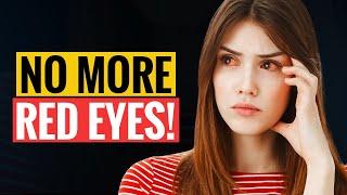 No More Red Eyes! Crucial Tips to Avoid Red Eyes