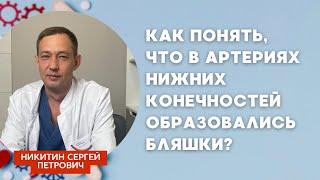 Как понять, что в артериях нижних конечностей образовались бляшки? Ответил хирург Сергей Никитин