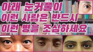 아래 눈커풀이 이런 사람은 반드시 이런 병을 조심하세요 #관상 #사주 #관상 보는법 #제주 철학관