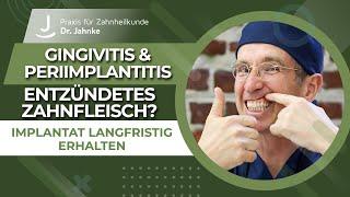 Gingivitis und Periimplantitis: Entzündetes Zahnfleisch und Zahnimplantate