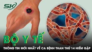 Bộ Y Tế Thông Tin Mới Nhất Về Ca Bệnh Than Thứ 14 Hiếm Gặp | SKĐS