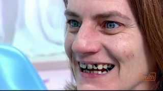 Rotten Teeth | Embarrassing Bodies