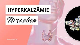 Hyperkalzämie: Wenn Calcium zur stillen Gefahr wird