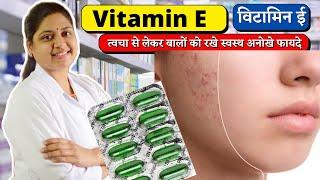 Natvie 400 - Natvie 400 Tablet Uses In Hindi - Evion 400 - Vitamin E Capsules Usp 400 Mg - Natvie