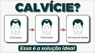 Tratamento barato, eficiente e prático para QUEDA DE CABELO MASCULINO