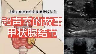 甲状腺结节---超声室的故事【Ultrasound Room】Diagnosing Thyroid Nodules on Ultrasound