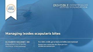 Managing Ixodes scapularis bites