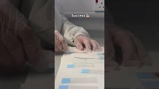 Soi máu dưới kính hiển vi