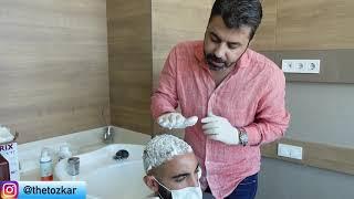 First hair wash after hair transplant operation.