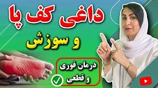 داغی کف پا از چیست؟ | علل و درمان فوری داغی کف پا و سوزش کف پا در خانه