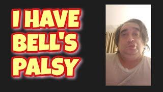 I HAVE BELL'S PALSY | PARALYSIS TO ONE SIDE OF MY FACE | MUST WATCH