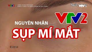 Nguyên nhân gây sụp mí mắt - VTV2 - Đông Y chữa sụp mí mắt