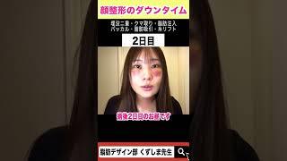 【顔の整形】５日間でダウンタイムはどうなる？ #Shorts