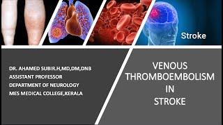 STROKE ESSENTIALS#VENOUS THROMBOEMBOLISM IN STROKE SIMPLIFIED#MUST KNOW IN STROKE