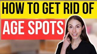 How To Get Rid Of Age Spots | Dermatologist Tips