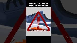 40대 남성 벌어진 앞니 치료 과정 대공개