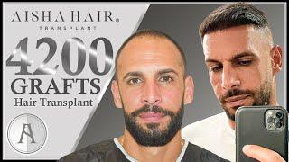 Aisha Hair Transplant Revolution in Turkey | Revolución de Injerto Capilar Aisha Hair en Turquía