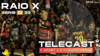 SÉRIE B - RAIO X | SPORT 2 X 1 CHAPECOENSE - 45 MINUTOS